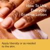 Acure Everyday Eczema Lotion – Healing Anti-Itch Eczema Cream for Dry Skin, Body Lotion with Oatmeal, Soothing Moisturizer, Daily Repair Treatment for Itchy Skin, Use on Face & Body, Vegan – 8 fl oz(8 Fl Oz (Pack of 1))