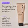 Acure Everyday Eczema Lotion – Healing Anti-Itch Eczema Cream for Dry Skin, Body Lotion with Oatmeal, Soothing Moisturizer, Daily Repair Treatment for Itchy Skin, Use on Face & Body, Vegan – 8 fl oz(8 Fl Oz (Pack of 1))