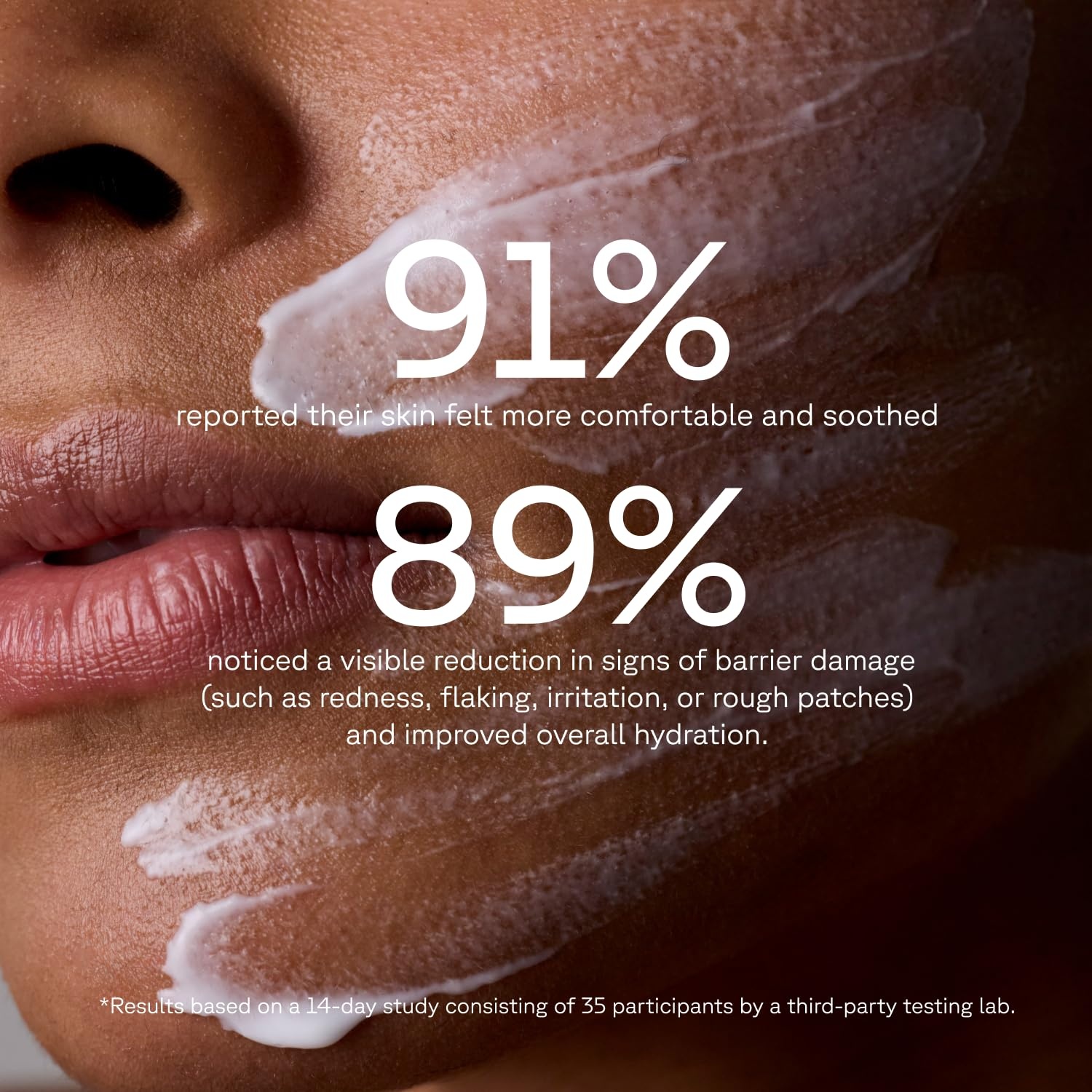 image:imageAcure Advanced Barrier Support Moisturizer Hydrating Facial Cream Complex Barrier Support for All Skin Types Contains Ectoin Plant Exosomes amp Ceramide Mesh Network 17 fl oz
