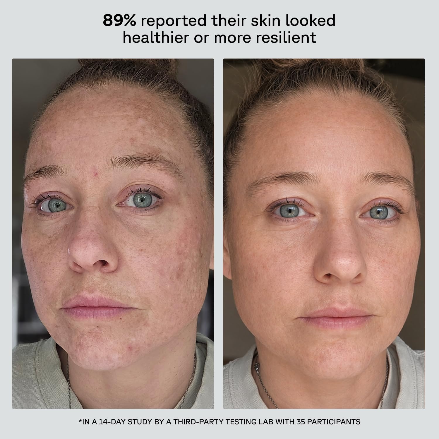image:imageAcure Future Fusion PM Face Moisturizer Nightly Hydration Serum for Women amp Men Firming amp Smoothing Retinol and Hyaluronic Acid Blend Refines the Look of Skin Texture amp Tone 17 fl oz