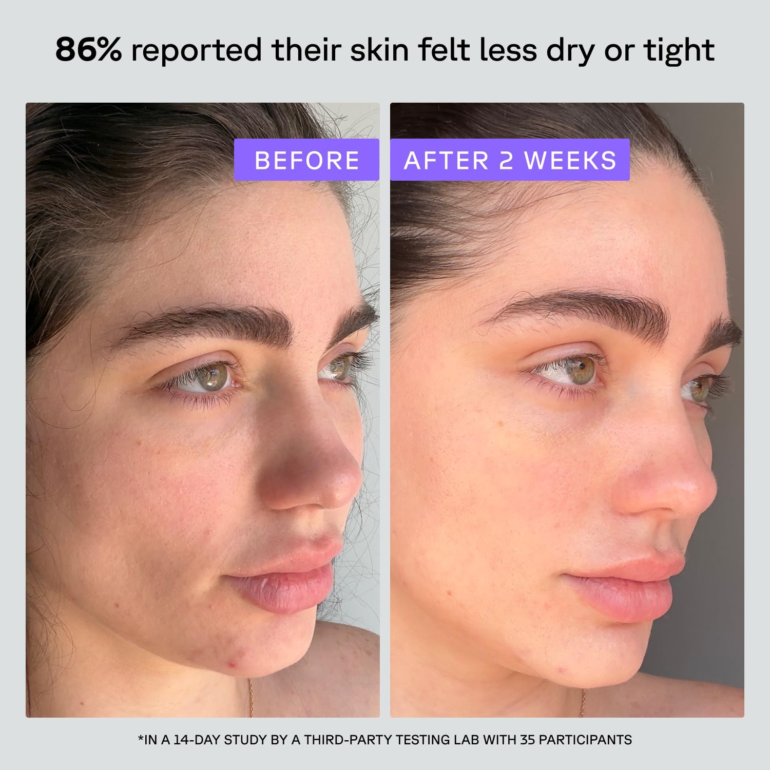 image:imageAcure Super Drench Face Serum 30 Glycerin amp Polyglutamic Acid Barrier Repair amp Firming for Dry Skin Illuminating Lightweight Elixir Natural Skincare for Women amp Men 1 fl oz