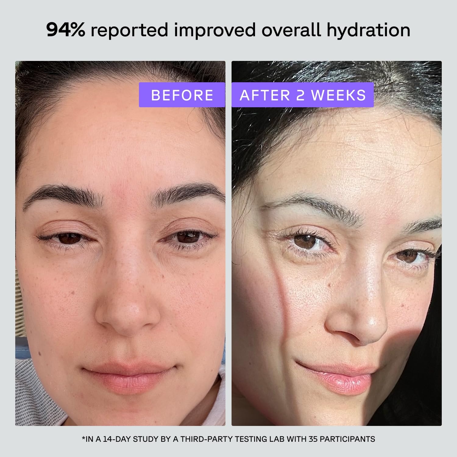 image:imageAcure Super Drench Face Serum 30 Glycerin amp Polyglutamic Acid Barrier Repair amp Firming for Dry Skin Illuminating Lightweight Elixir Natural Skincare for Women amp Men 1 fl oz